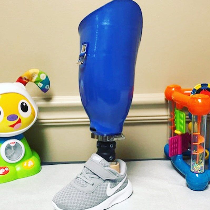 IMG_5227 blue prosthetic leg