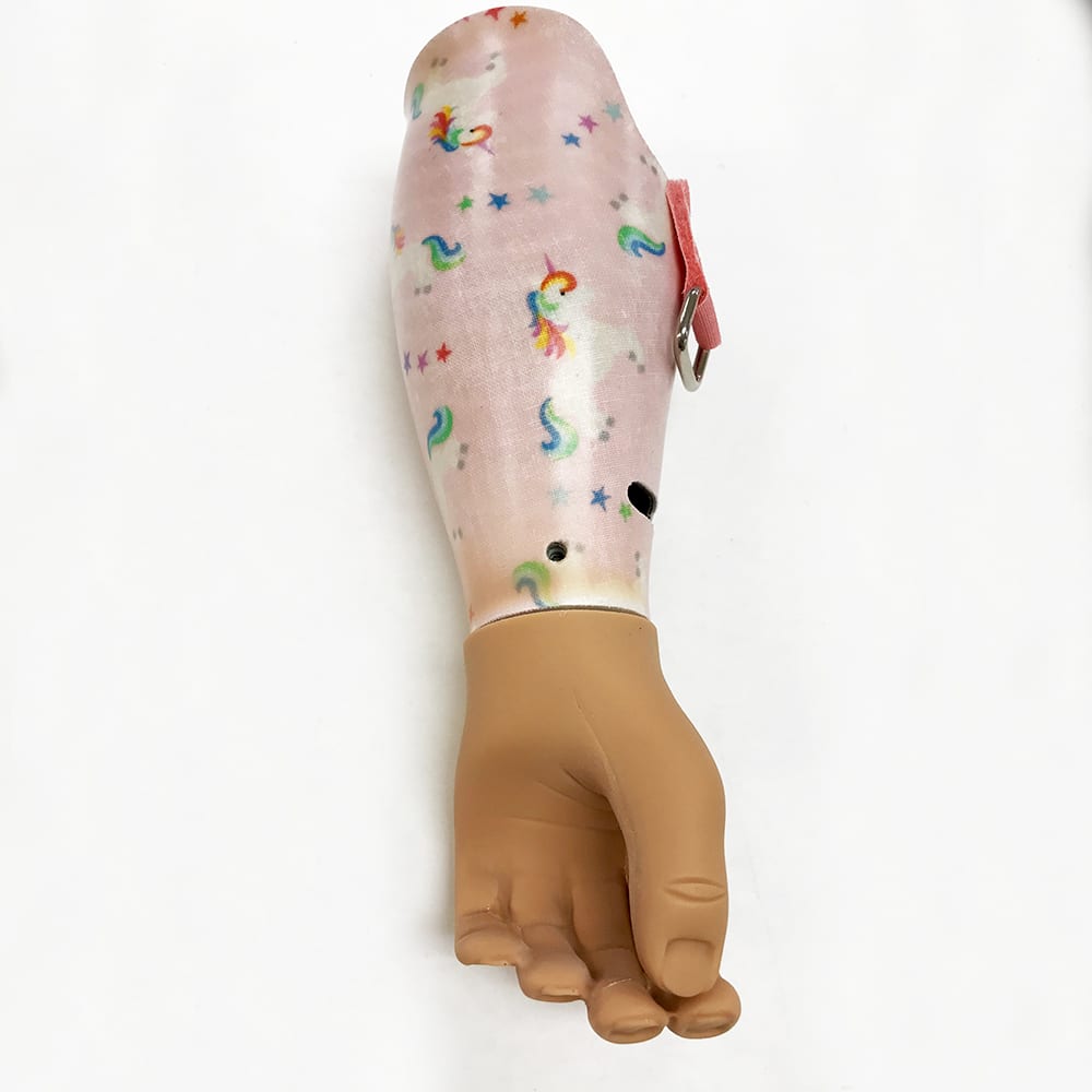baby-girl-prosthetic3 baby prosthetic arm
