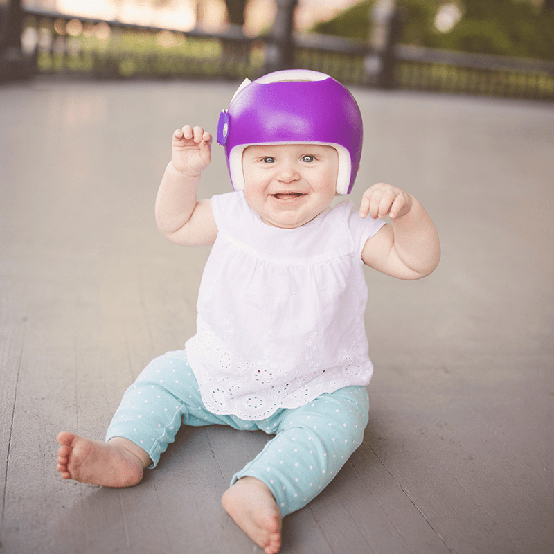 cranial-patient-girl baby with a cranial molding helmet