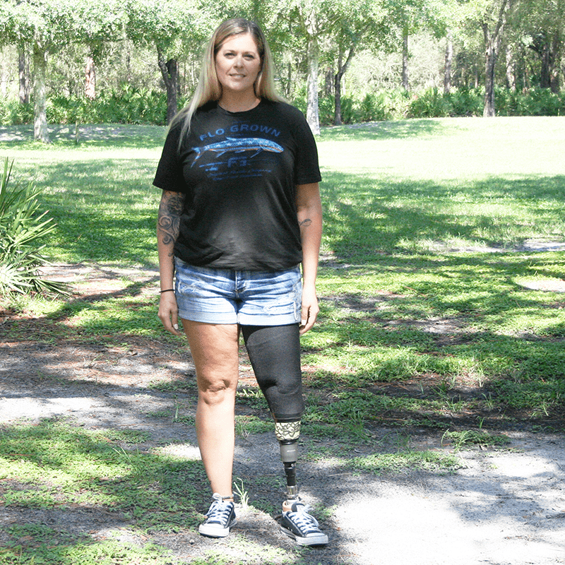 female with leg prosthesis