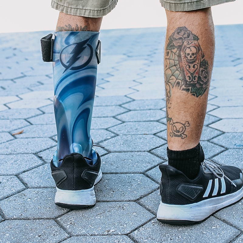 lower-limb-orthotics-wcbl10 man with prosthetic leg
