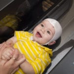 cranial scanning