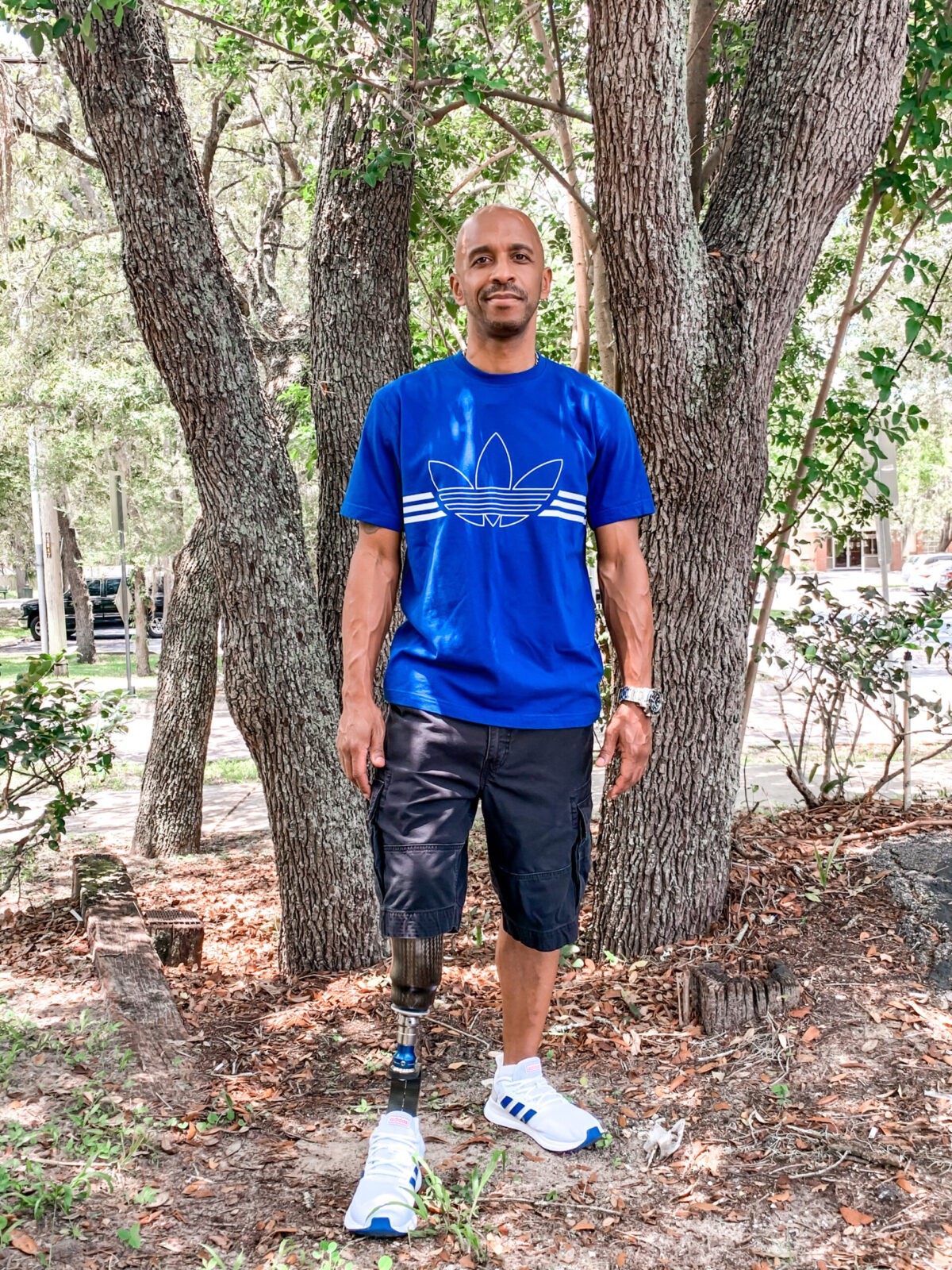 amputee man wearing prosthetic leg standing outside
