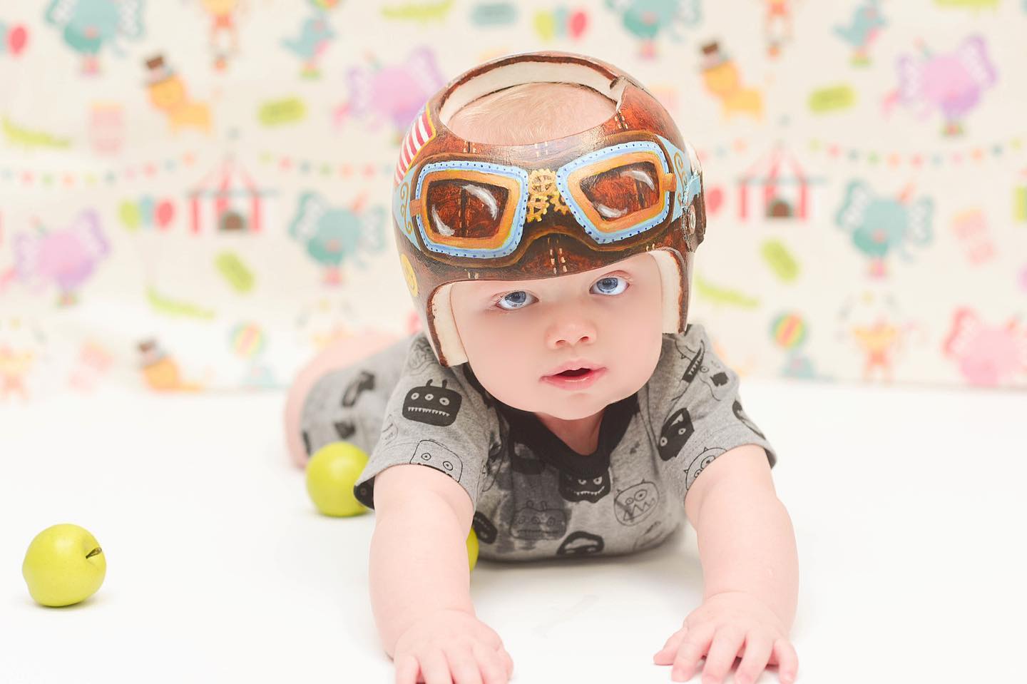 baby in cranial remolding helmet