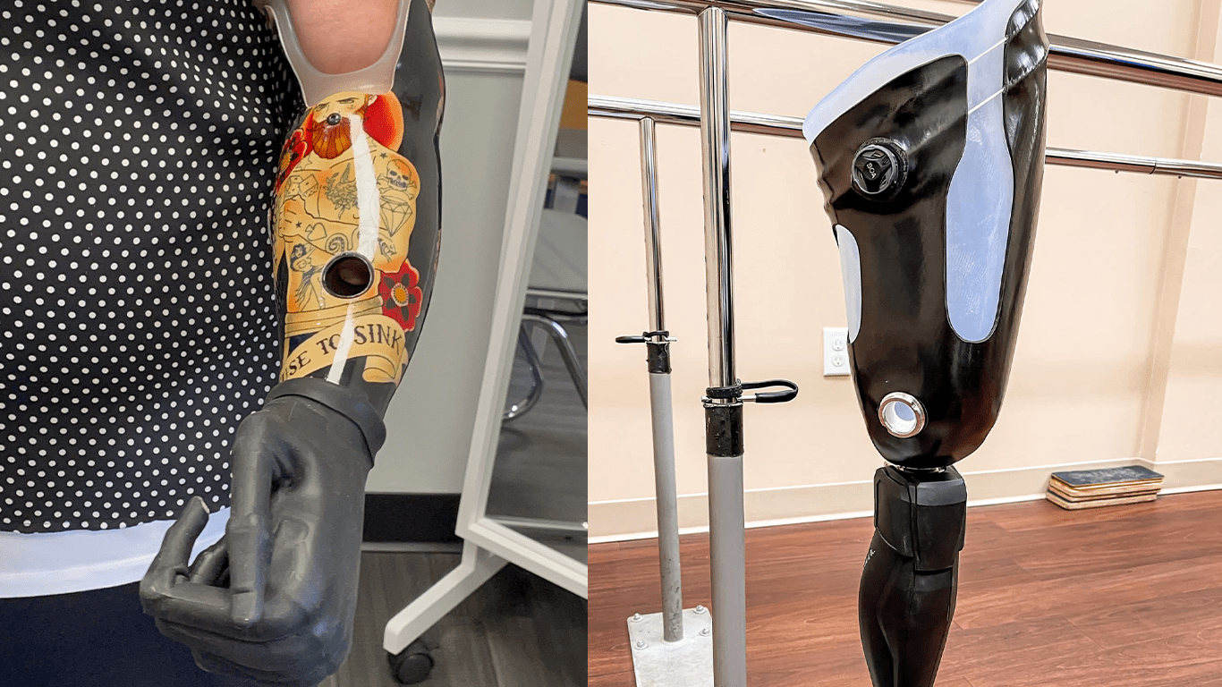 HiFi Interface Technology – Prosthetic Socket