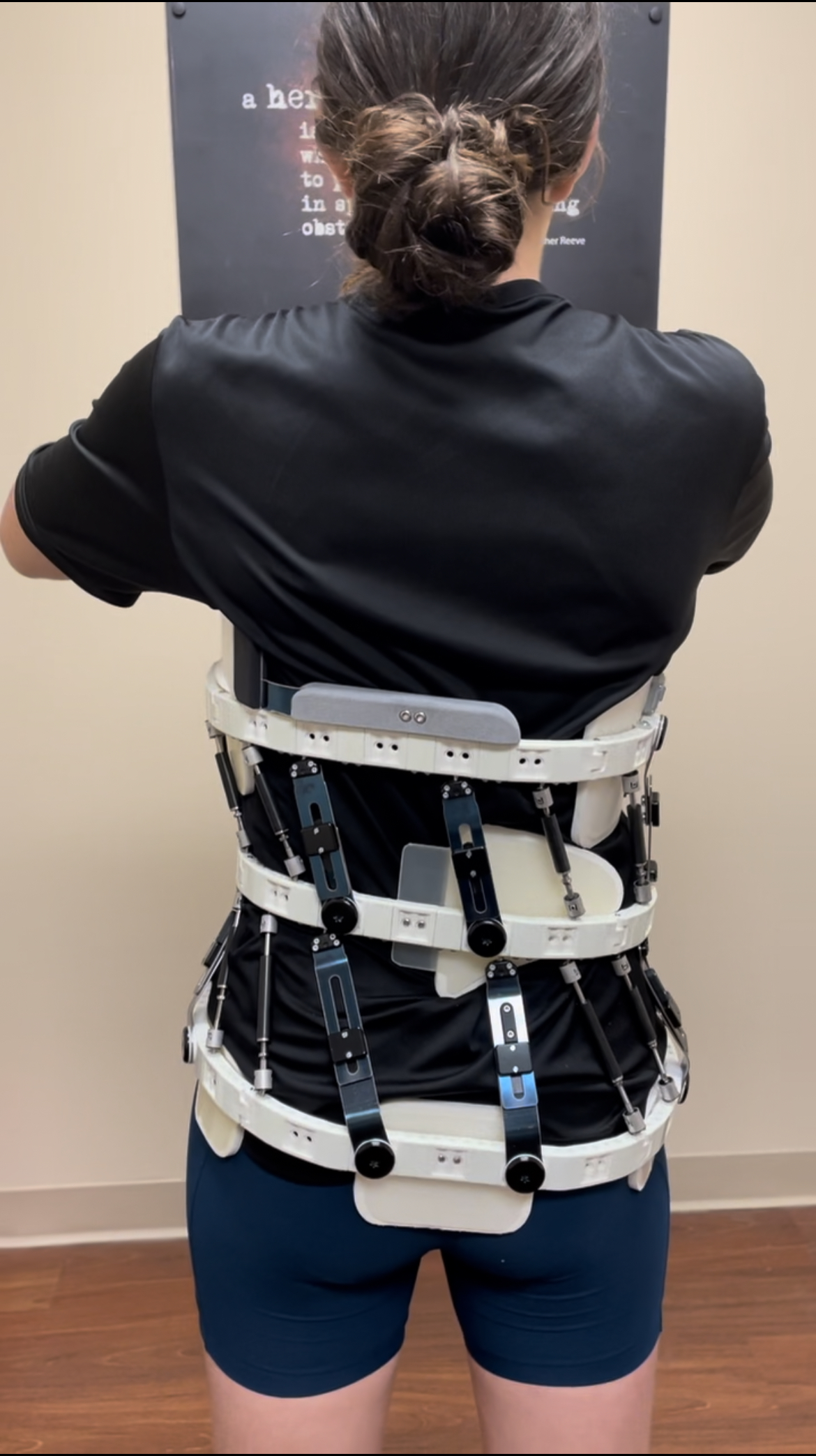 Whisper Scoli Brace back view